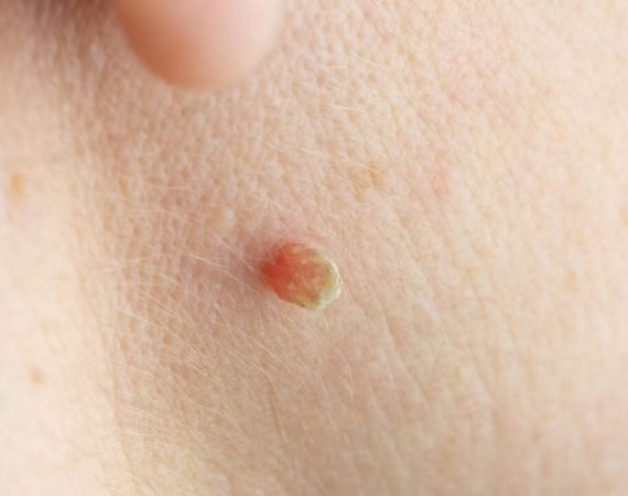 xr:d:DAFlbp7OHW8:53,j:590371683900779744,t:23081819